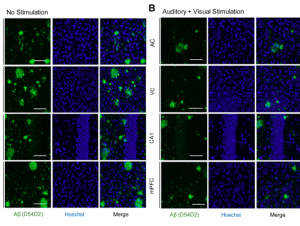 Before (left) and after images of reduced amyloid plaques in mice brains from a 2019 study.