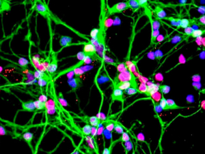 Neurons growing in a culture dish (NASA) Neurons growing in a culture dish (NASA)